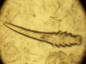 Демодекс под микроскопом